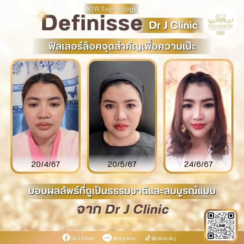 คลินิกปรับรูปหน้า กรุงเทพ